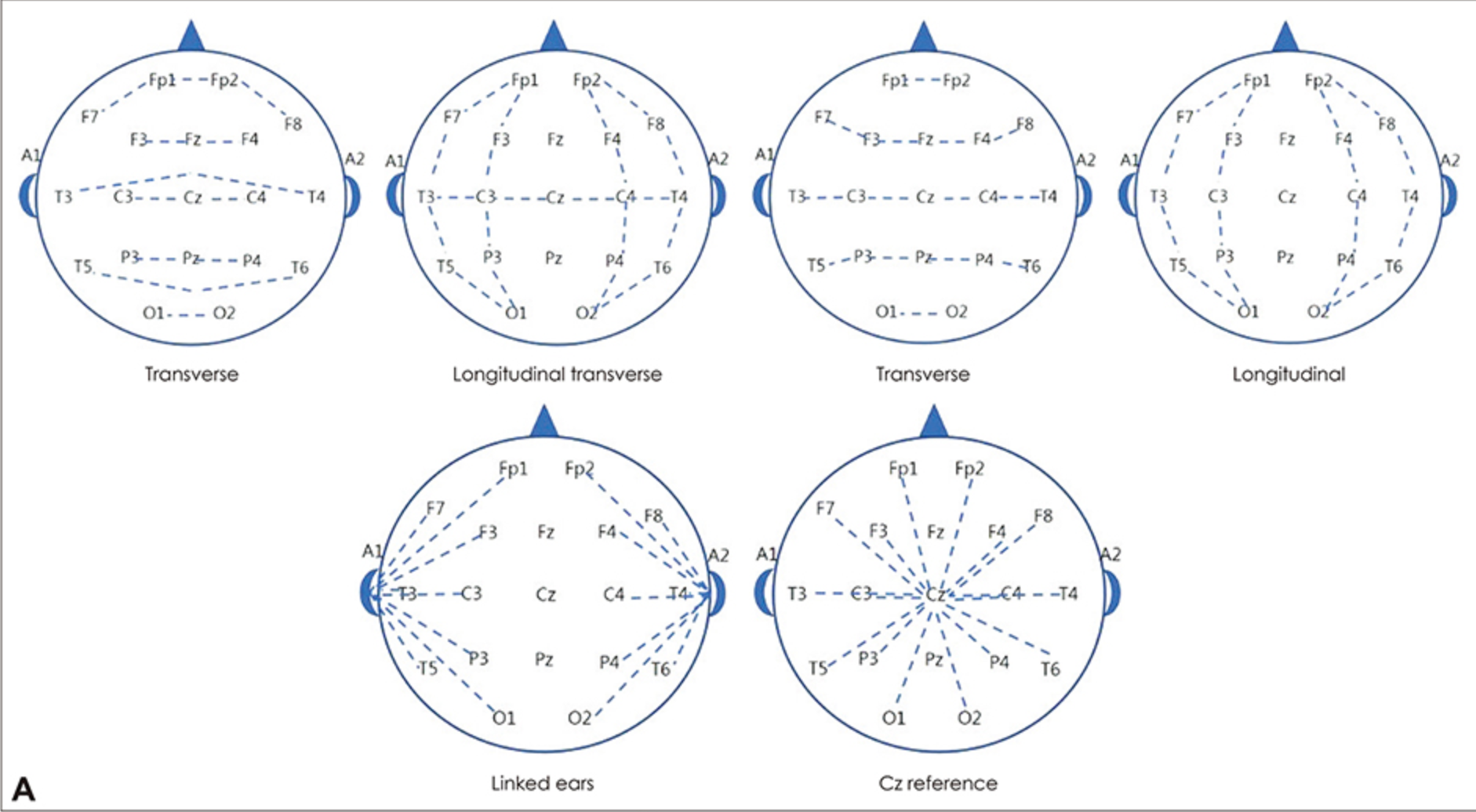 Montage maps and polarity of EEG. Spectral peaks montage maps。软件层面的reference