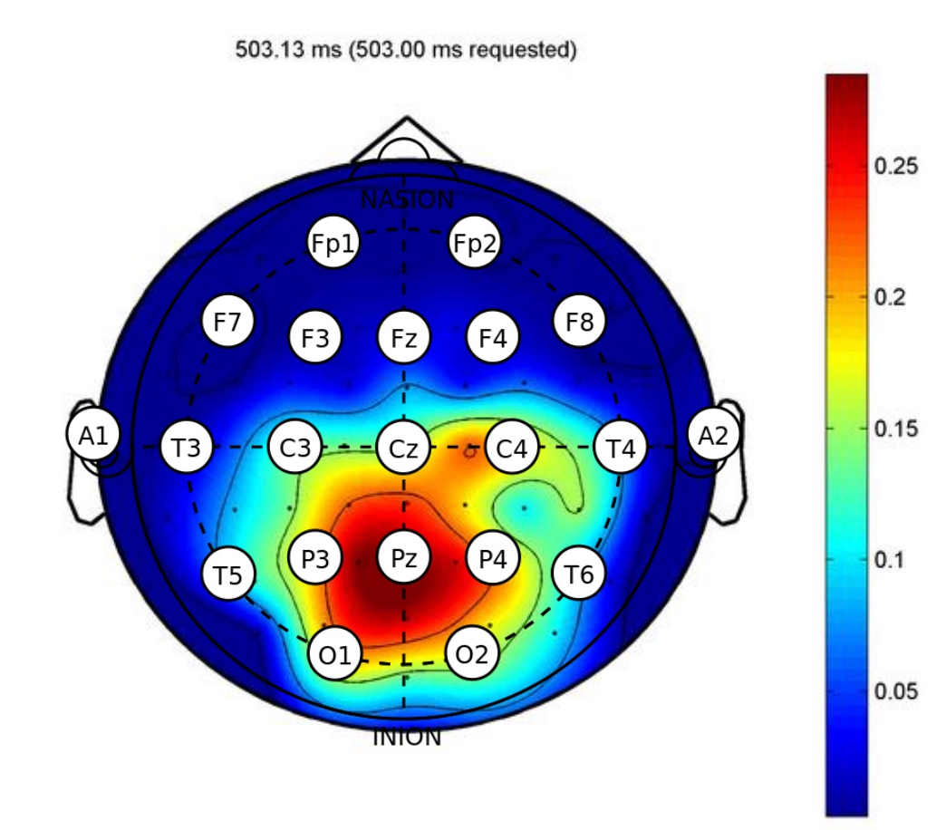 Topographical Localization