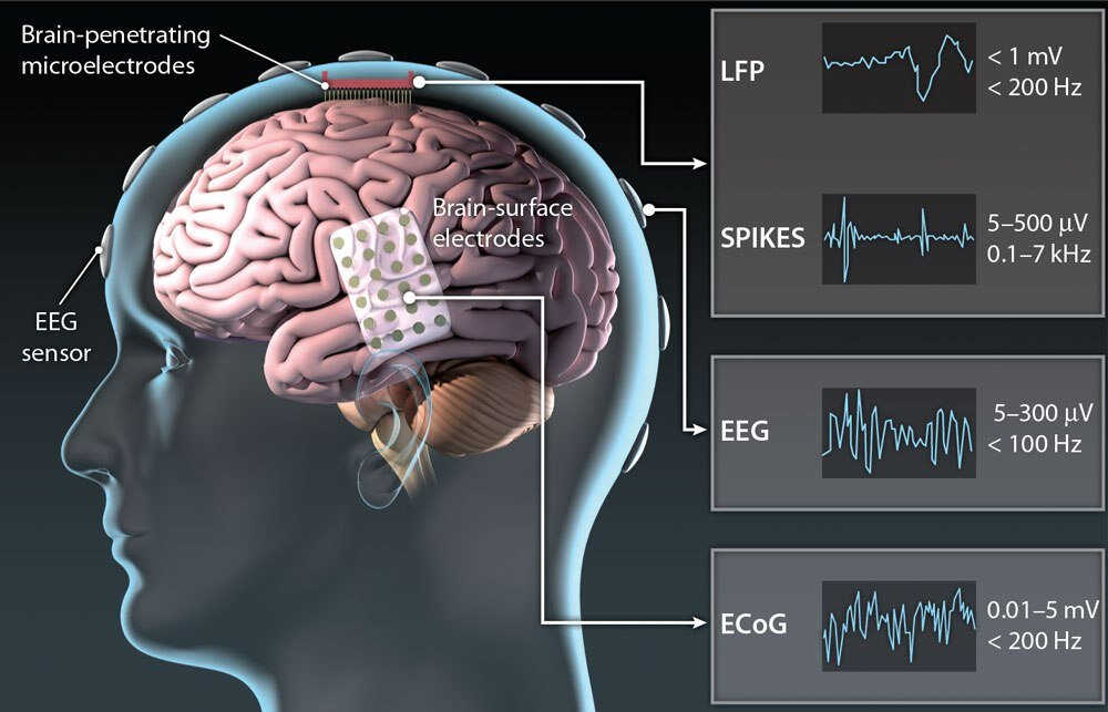 EEG Variants