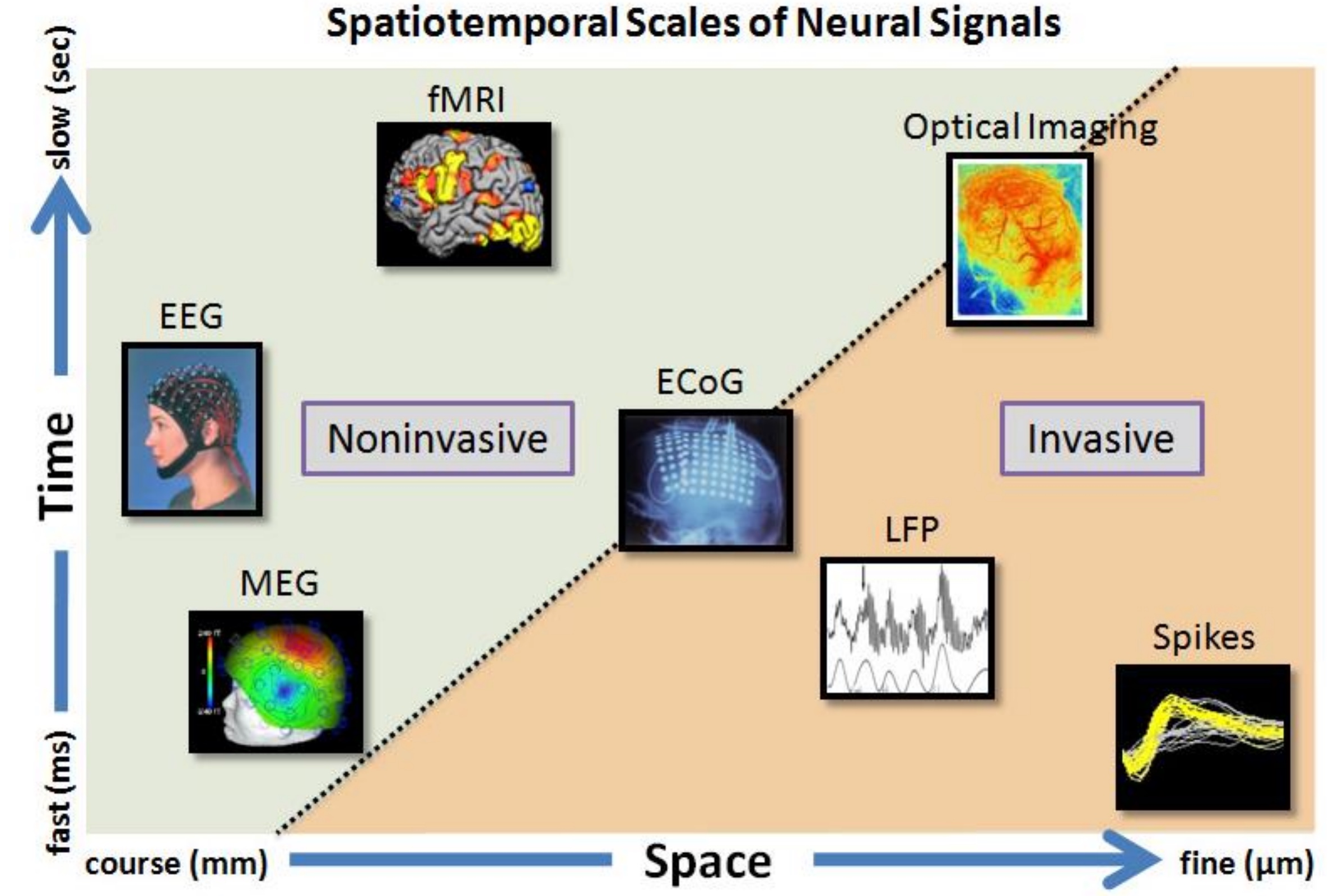 EEG Variants